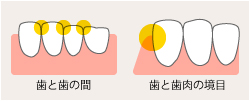 月に1度のクリーニングシステム