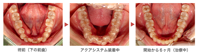 症例写真
