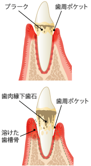 ペリオとは